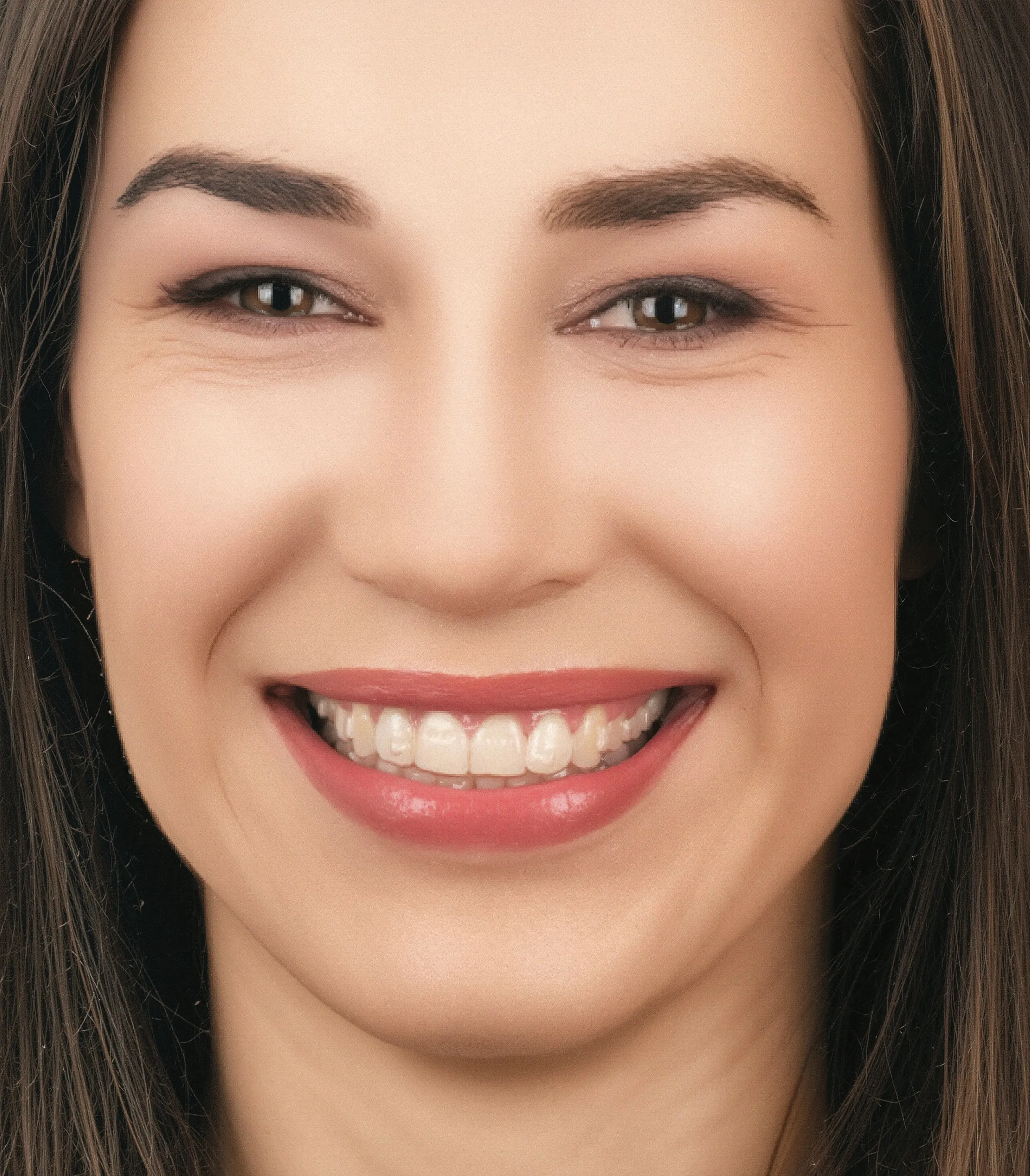 Een glimlach met vrijwel onzichtbare aligners