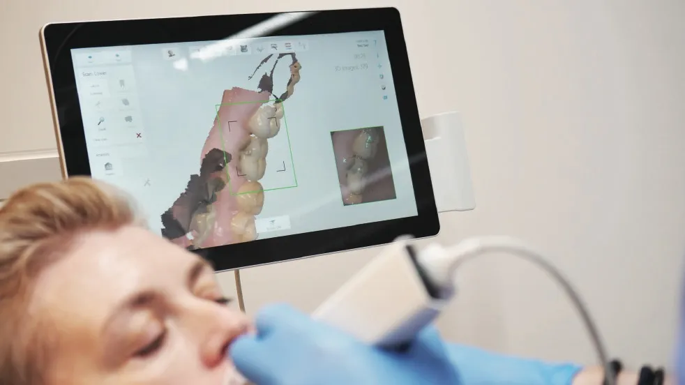 Een intra-orale scan van het gebit tijdens de consultatie